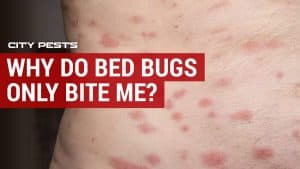Why do bed bugs only bite me and not everyone? - CITY PESTS